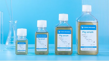 Why Anne Hathaway and other women are saying haters 05